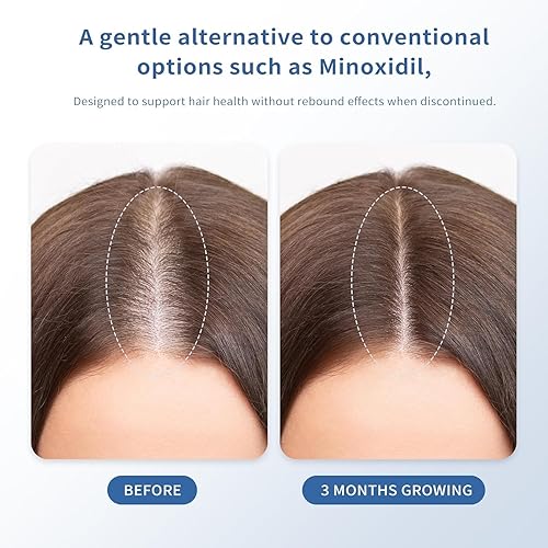 Miniatura 6 de Suero para el crecimiento del cabello para adelgazar el cabello, fortalece y espesa con biotina, roll-on de rápida absorción, no necesita enjuague