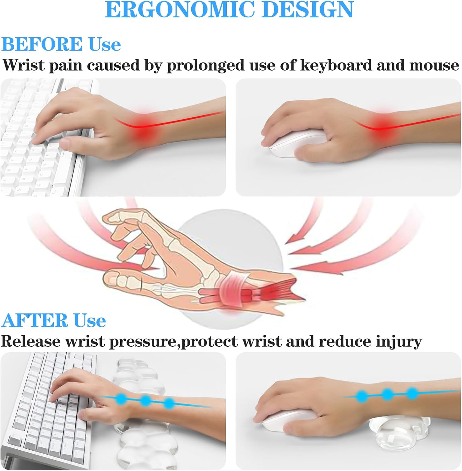 Acrylic Transparent Computer Keyboard Stand with Gel Cloud Keyboard and Mouse Wrist Rest, Ergonomic Tilting 3-in-1 Set, Relieves Painful Typing, for Office/Computer/Laptop/Gaming