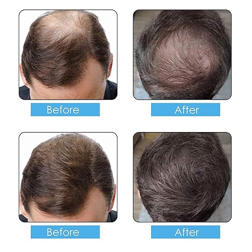 Miniatura 2 de Polvo de repuesto en aerosol de fibras capilares, 3.53 oz, marrón oscuro, corrector de pérdida de cabello fino, sin detectar y sin perfume, botella