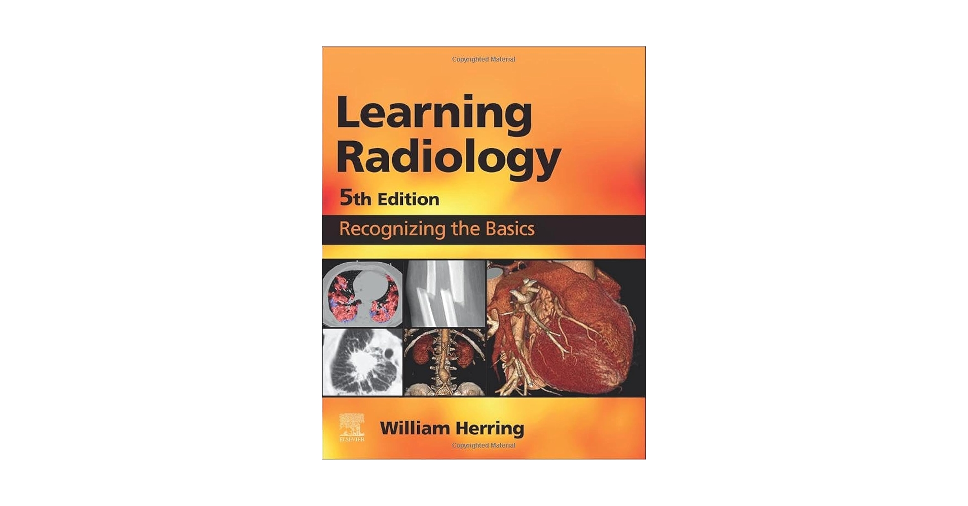 Learning Radiology: Recognizing the Basics， 3e Herring MD  FACR， William Amazon.com: Learning Radiology: Recognizing the Basics eBook
