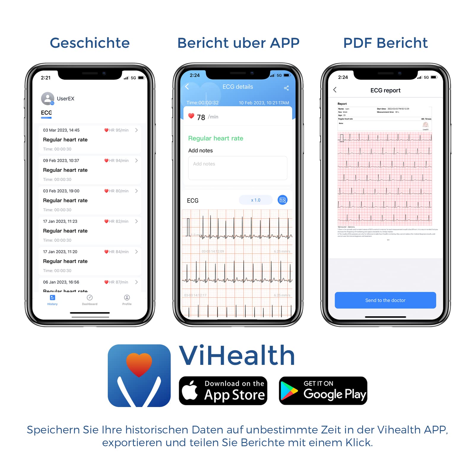 Wellue Pulsebit EX ECG Monitor, appareil ECG Bluetooth avec application iOS et Android, enregistrement 30s / 60s / 5min, fonctionne avec smartphone et PC, traceur de santé cardiaque portable personnel