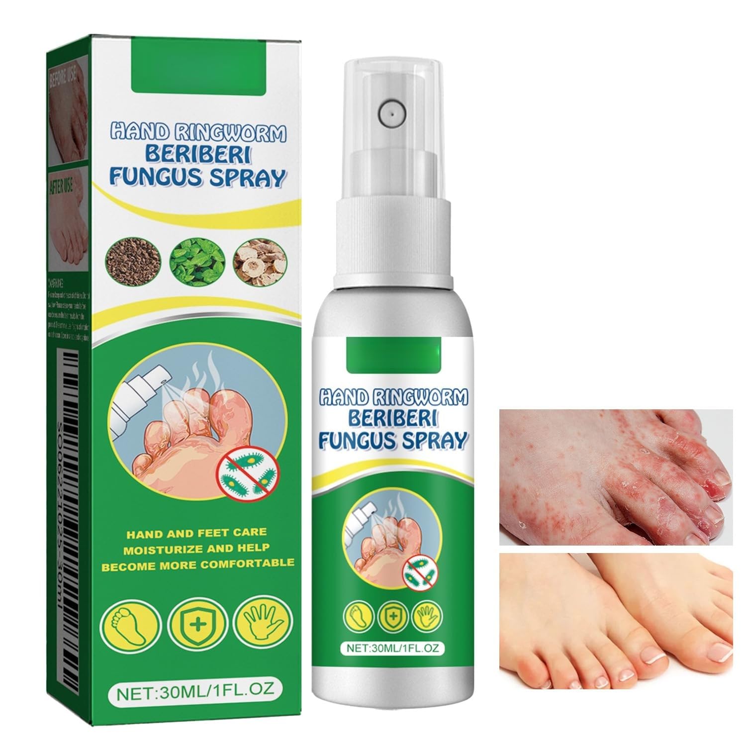 Spray para Pies, Spray para Pie de Atleta, Spray para el cuidado de los pies, Hidratante y reparador, Mujeres y Hombres Adultos, 30ml