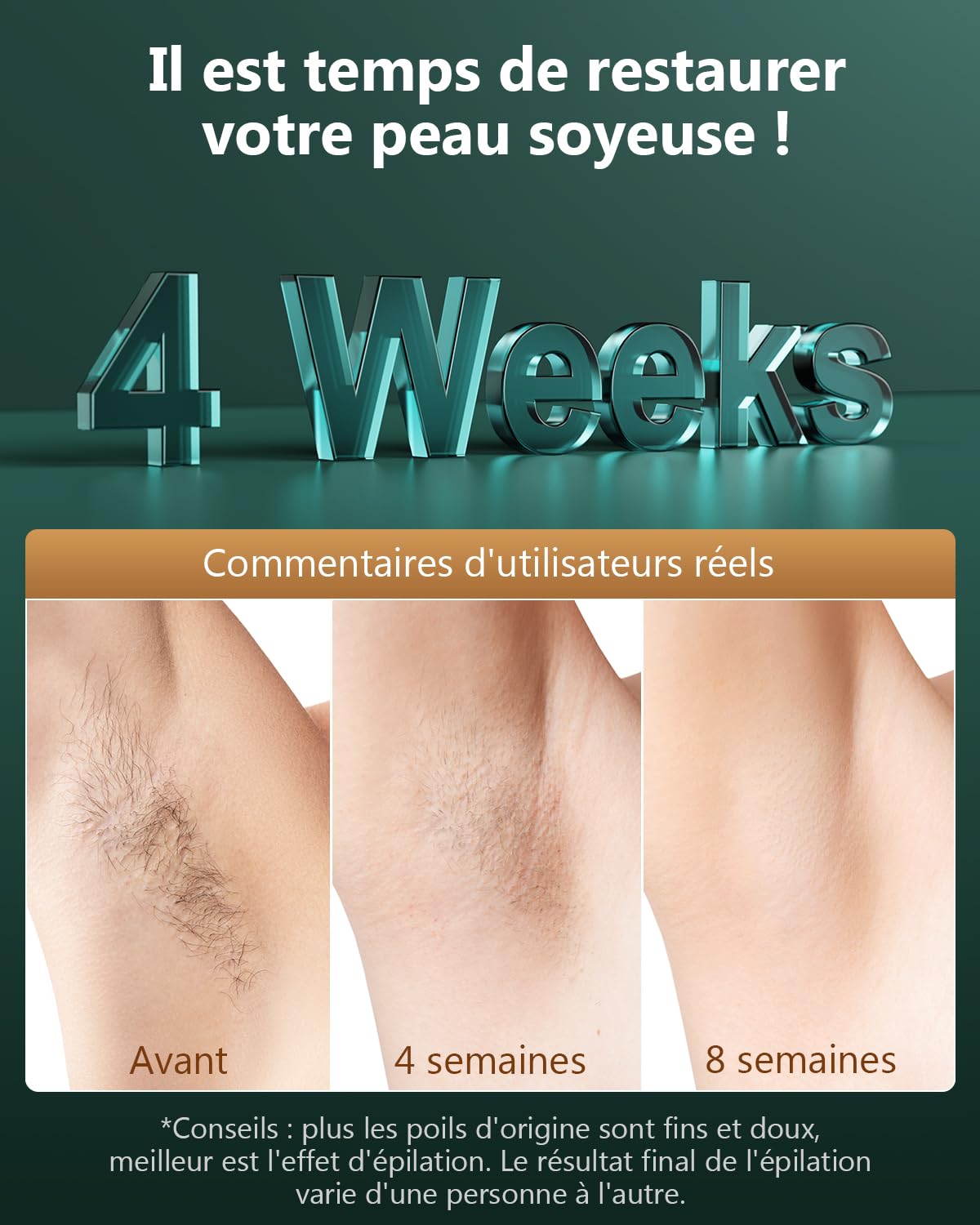 21J Épilateur Lumière Pulsée Avec Technologie Flash Rapide IGBT 0.8s, Infinite Scintillement 600-1200NM Lumière Pulsée Épilateur Féminin, 3 Modes Uniques Épilateur Laser Visage, Bikini, Corps