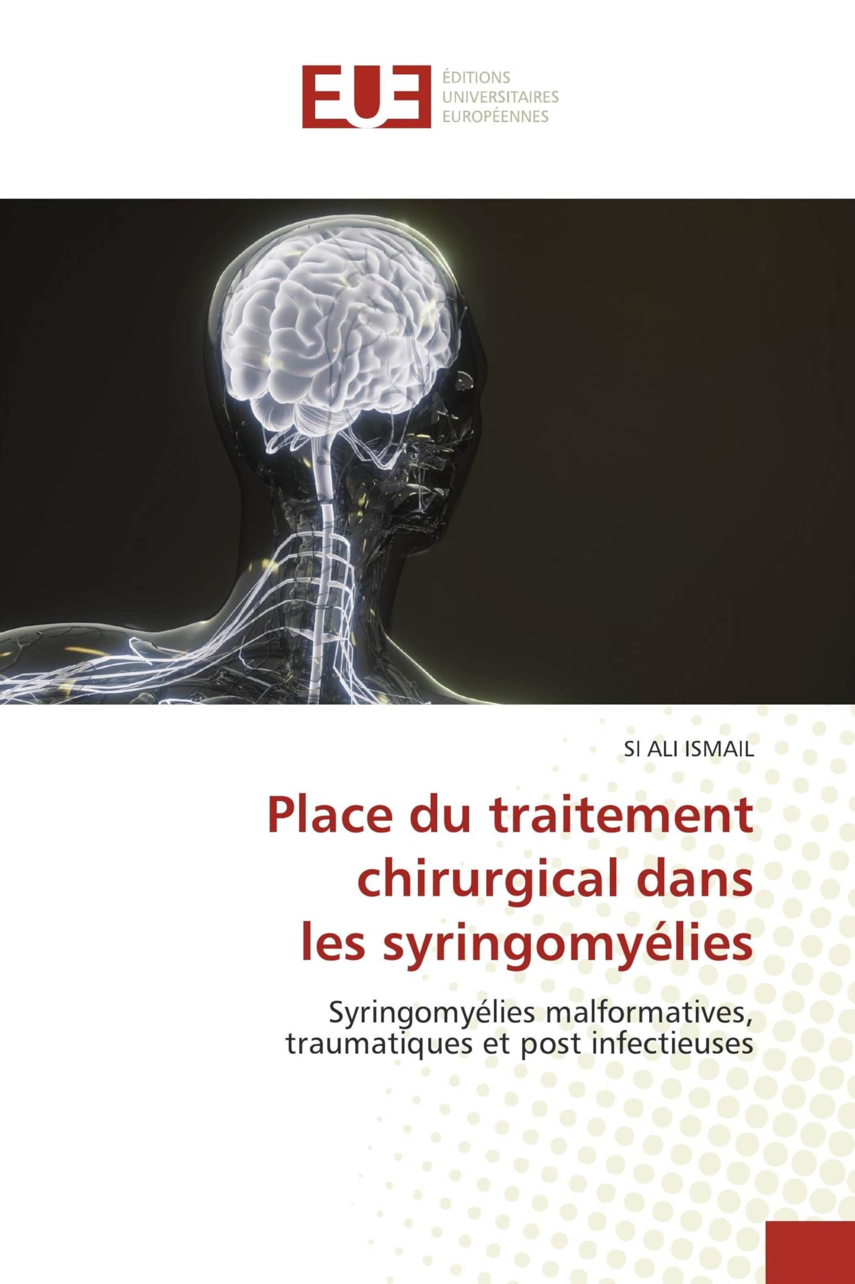 Place du traitement chirurgical dans les syringomyélies: Syringomyélies malformatives,traumatiques et post infectieuses