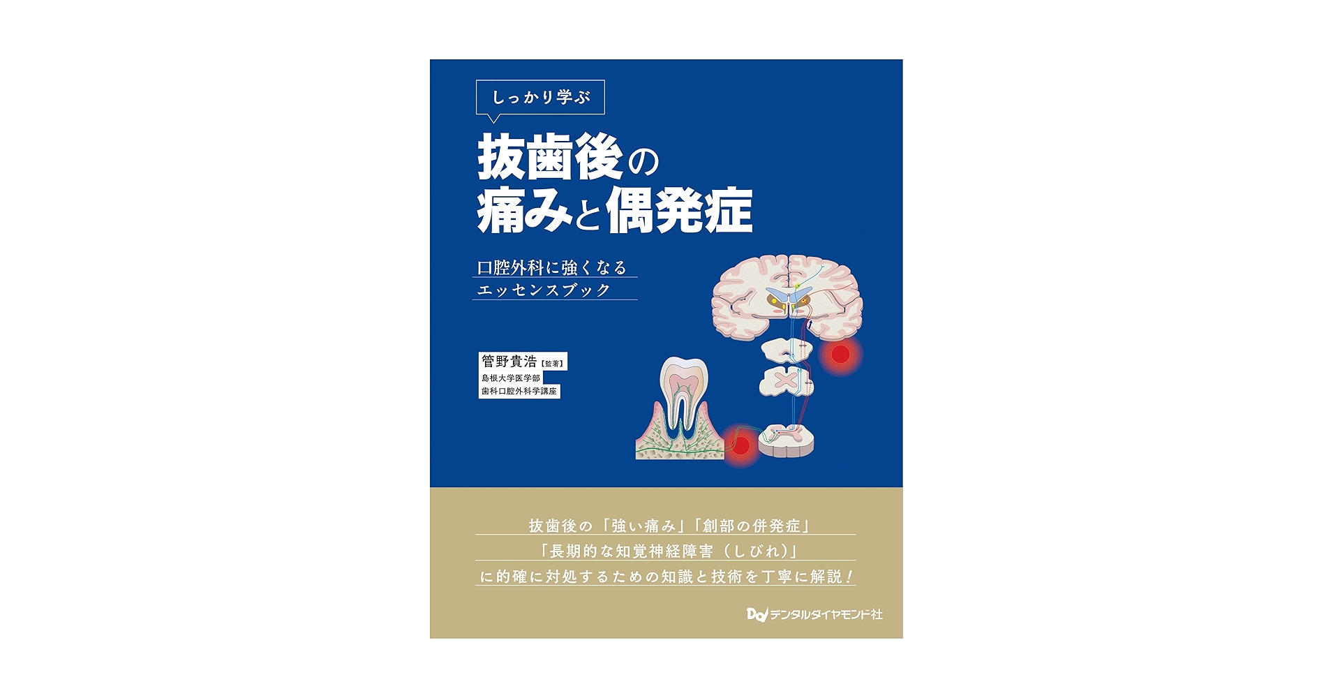 Amazon.co.jp: しっかり学ぶ抜歯後の痛みと偶発症 : 管野貴浩: 本