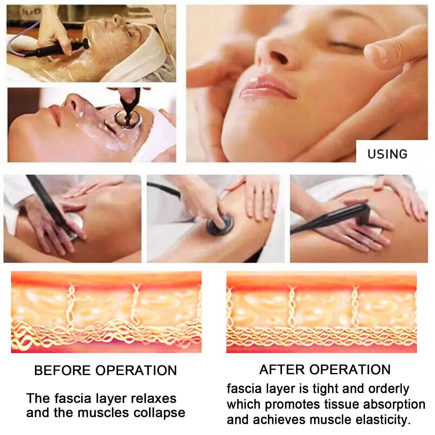 448 Khz Terapia Tecar, Urządzenie Do Diatermii Ret Cet, Wyszczuplające Ciało, Głęboka Pielęgnacja, Uśmierzanie Bólu, Ujędrnianie Skóry,Terapia Tecar Na Cellulit,Spalanie Tłuszczu