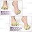 Dr. JK- ToePal Gel Toe Separator, 4 Pairs, Toe Spacers, Bunion Corrector