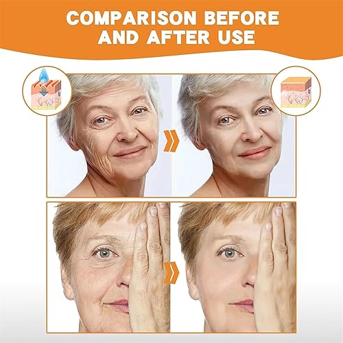 Miniatura 5 de Hojas de máscara facial disolviente de colágeno, juego de esencia de colágeno de venado y espipéptido, máscara de colágeno para la frente y las