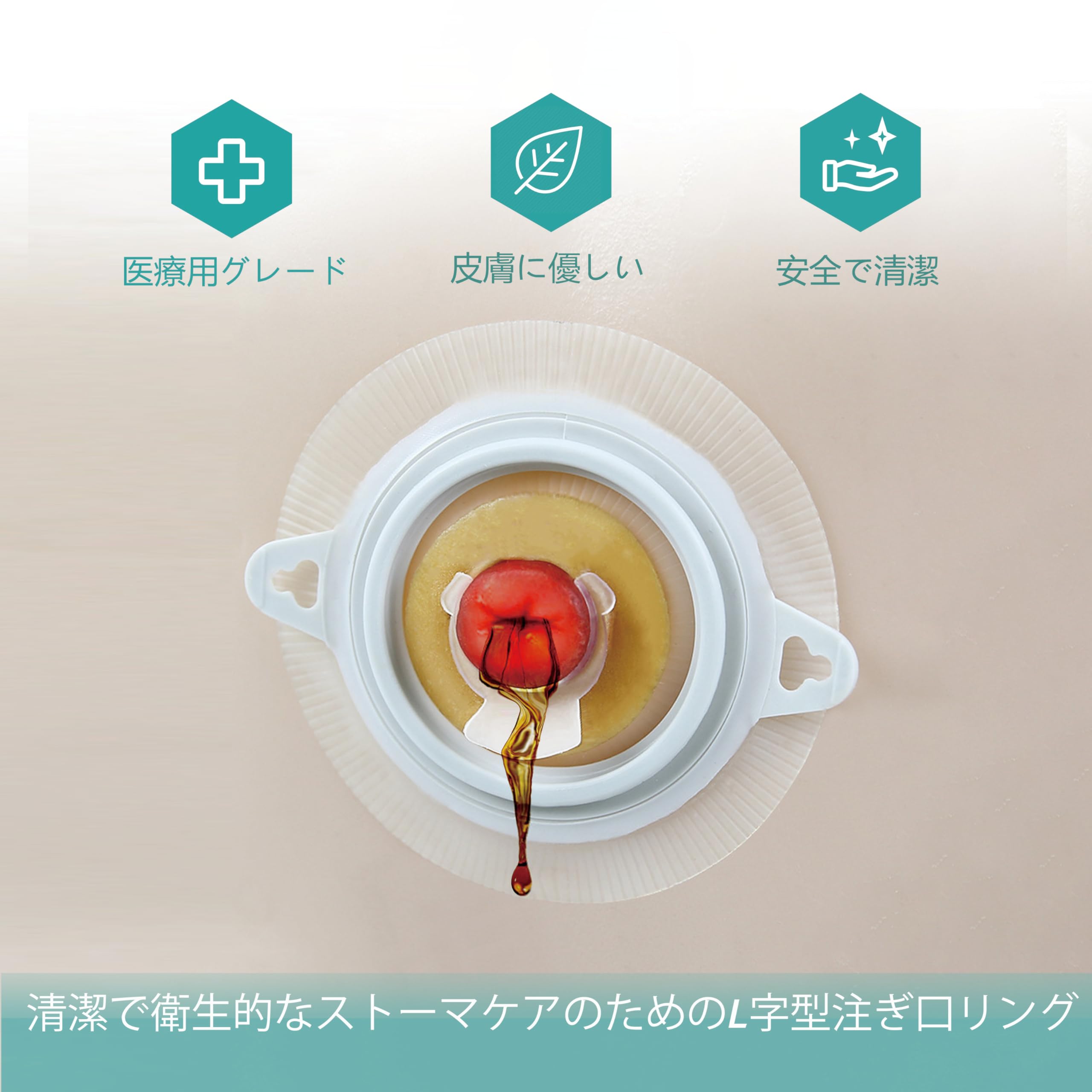 Ostomy Barrier Rings with L-shapped Output Direction Spout, Ostomy Stoma Rings with L-shapped Groove, Ostomy Supplies,Colostomy Supplies,4 Pcs/Pack (2 mm Thickness, Diameter : 2.4 Inches)