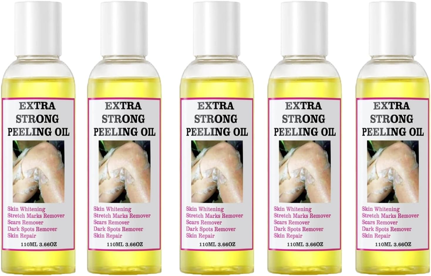 Extra Strong Peeling Oil, Yellow Peeling Oil for Dark Skin, Natural Formula Exfoliating Peels Solution for Face, Body, Hands and Foot Dead Skin Remover