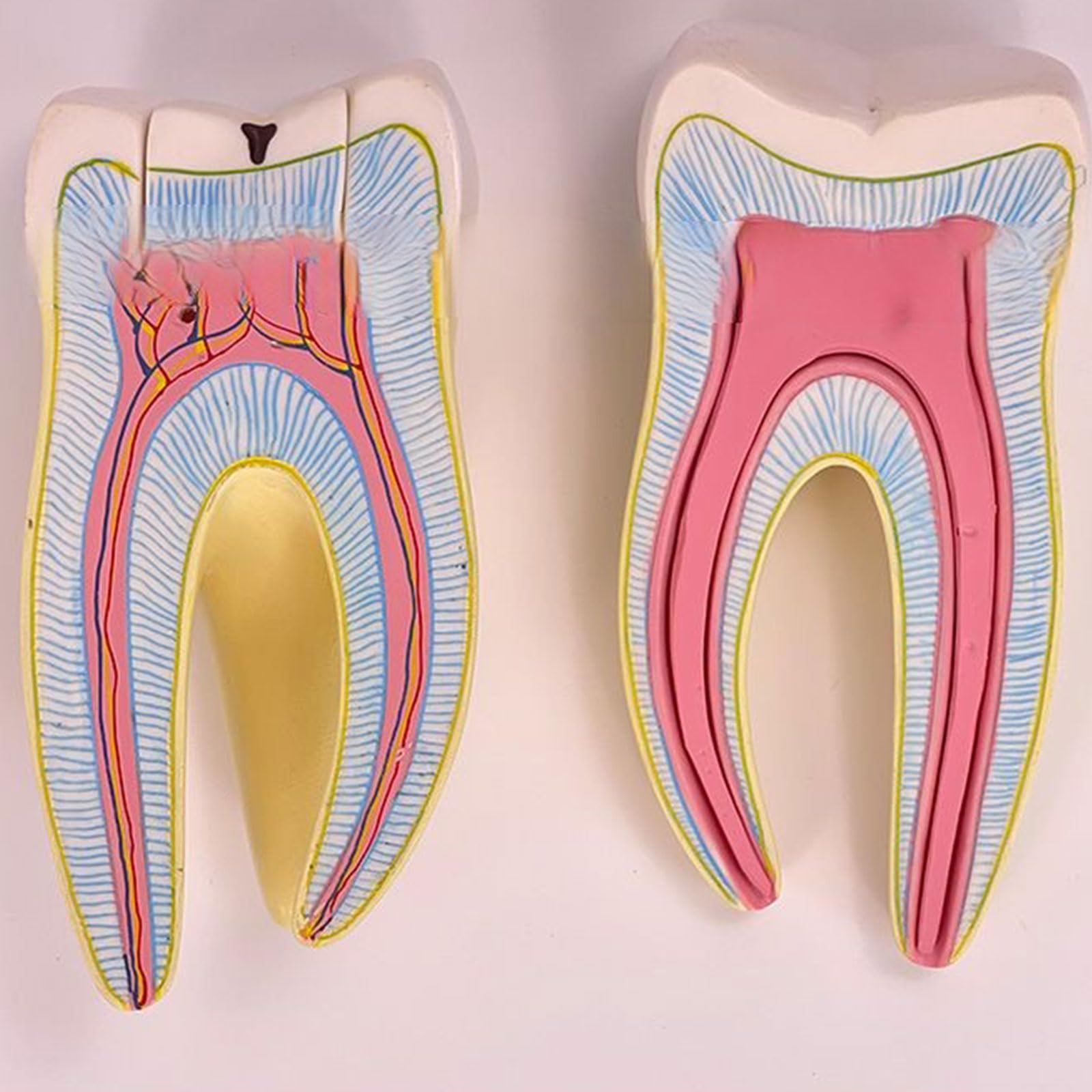 Modèle d'anatomie dentaire Modèle d'anatomie molaire avec pièces détachables Modèle de dent humaine pour l'étude des maladies dentaires
