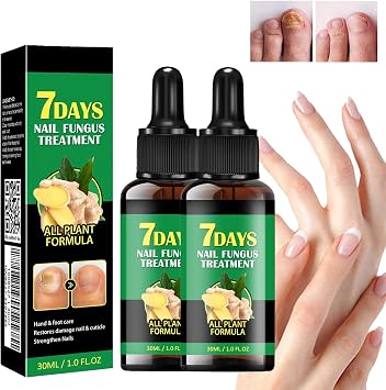 Toenail Fungus Treatment Extra Strength-7 days nail fungus treatment,Ginger Nail Treatment,Toenail Cuticle Care Oil Care,Multi-Purpose Nail Repair for Your nails a Natural Shine 2Pcs