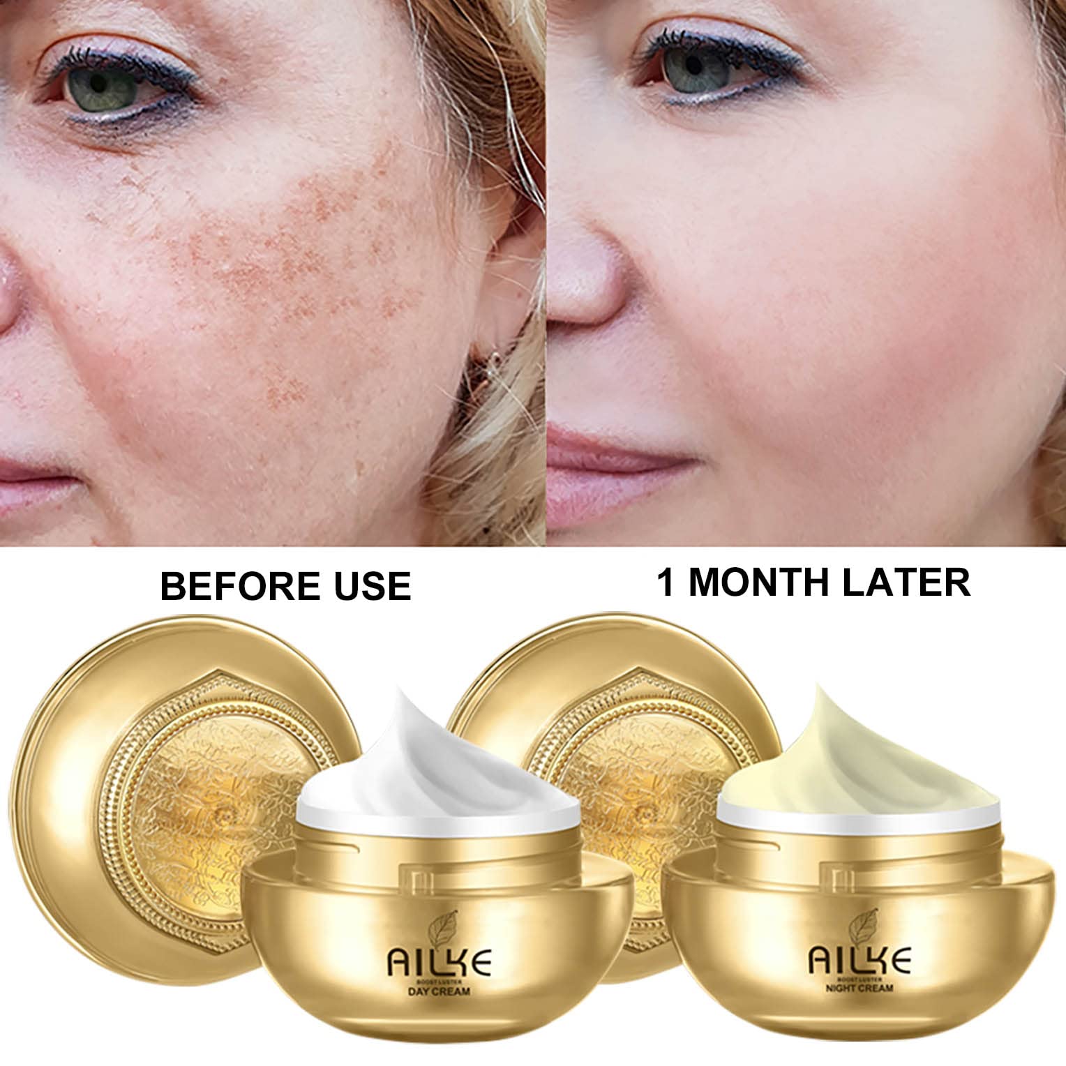 Sbiancante al collagene di qualità superiore, crema antimacchie scure, antimacchie, antimacchie, kit 5 in 1 con detergente per il viso, toner, sem, crema giorno e notte