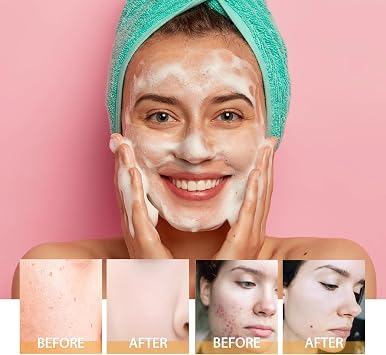 Turmeric Foaming Cleanser, Turmeric Facial Cleanser, Brightening Facial Skin, Deep Cleansing for Dark Spots and Even Skin Tone, Reduce Blemishes, Gentle Cleansing Foam for All Skin Types (1pcs)
