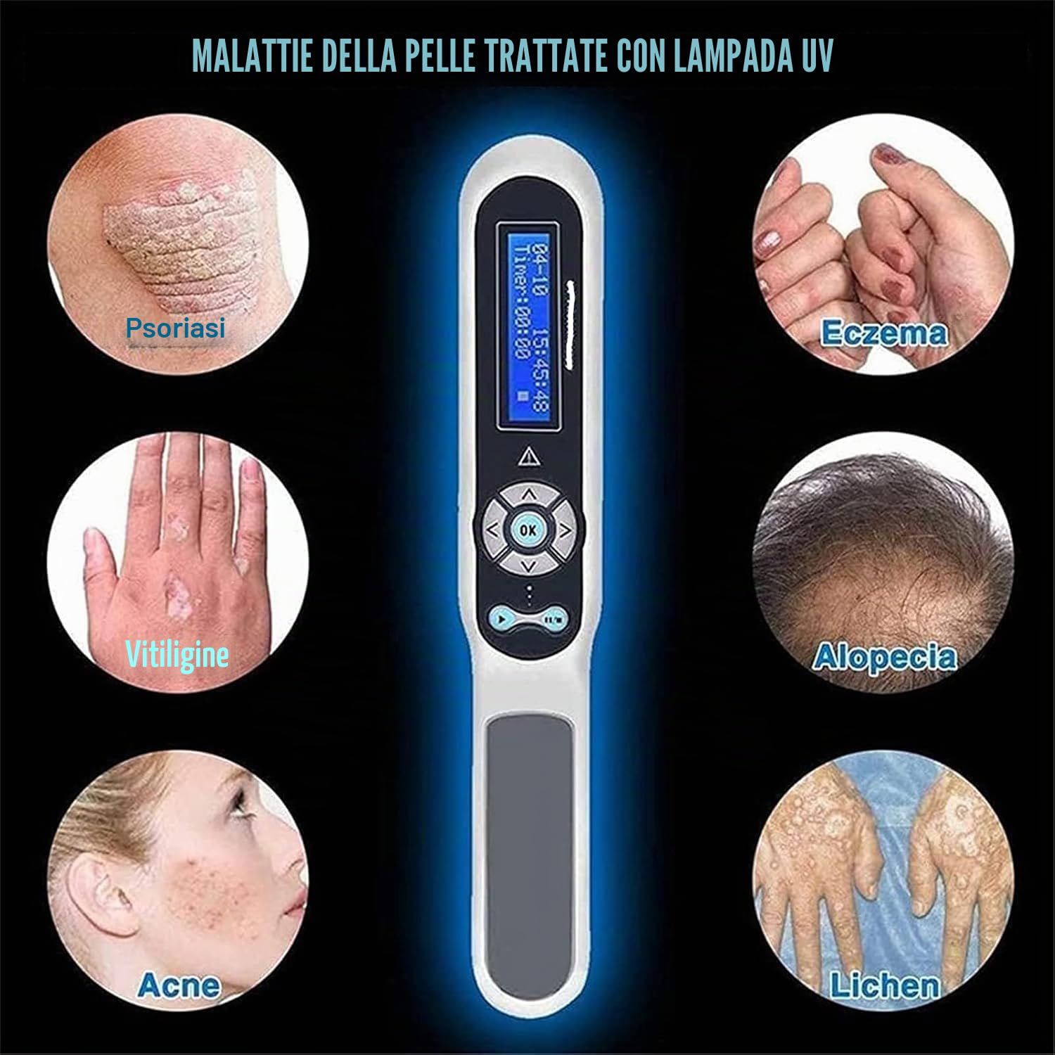 Lampada per fototerapia UVB per trattamento vitiligine 311 nm con timer e occhiali, dispositivo per fototerapia domestica per eczema e malattie della pelle