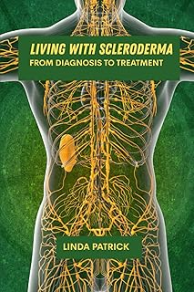 Living with scleroderma: From diagnosis to treatment