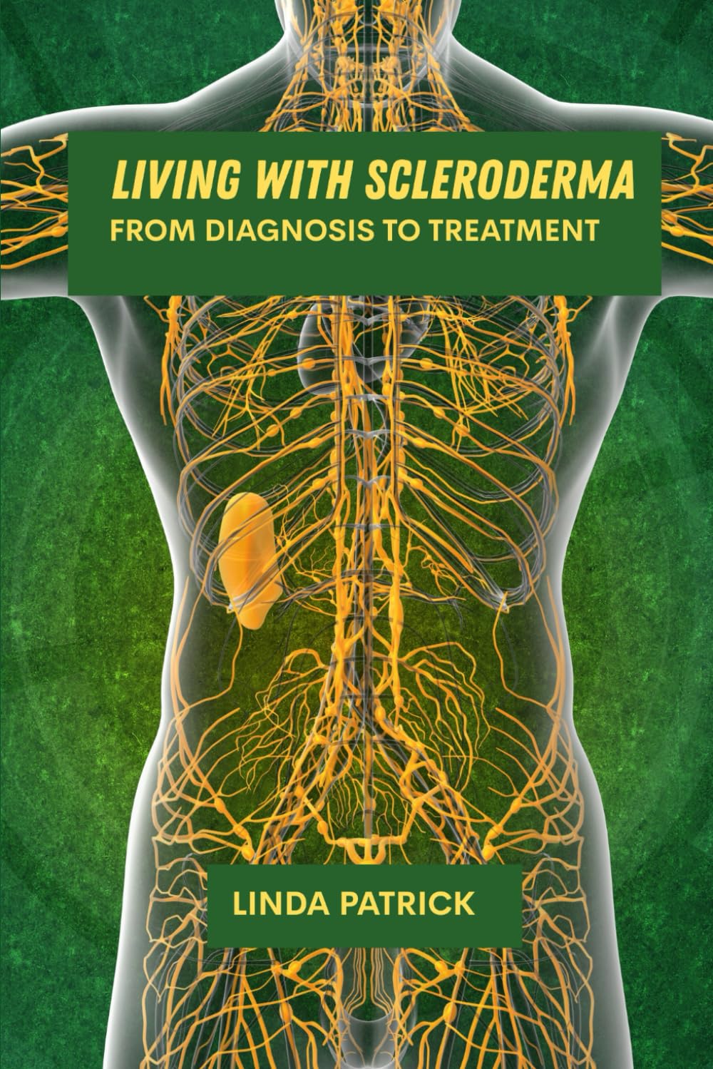 Living with scleroderma: From diagnosis to treatment      Paperback – June 1, 2025