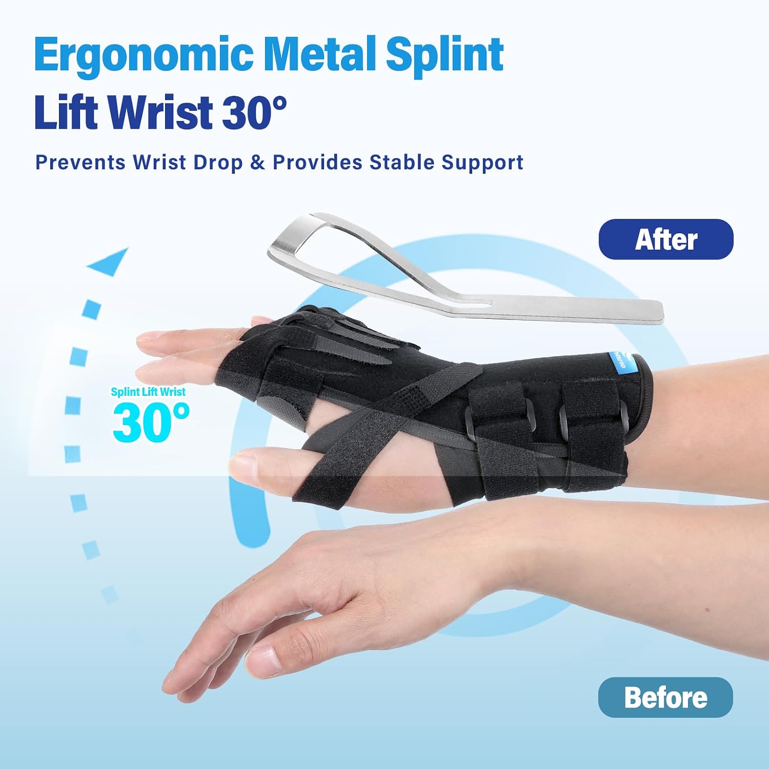 Radial Nerve Palsy Splint Wrist Drop Brace for Limp Finger Wrist Extension, Finger Limp, Crutch Palsy, Saturday Night and MCP Arthroplasty, Stroke Hand Recovery, Fits Right & Left Hand