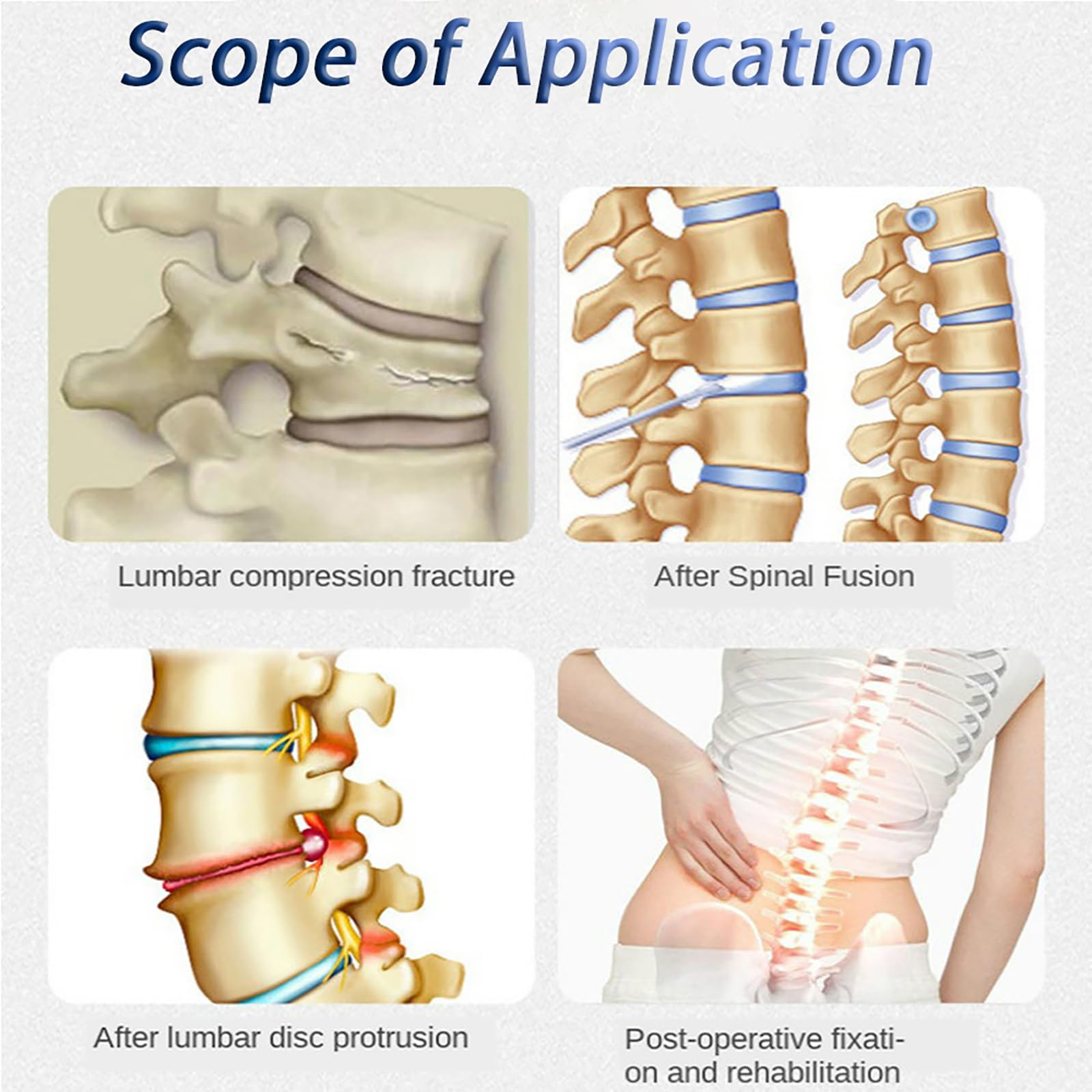 Cintura di supporto lombare, tutore posteriore regolabile con anello per il controllo della tenuta, tessuto leggero e traspirante per alleviare il dolore e decompressione bionica