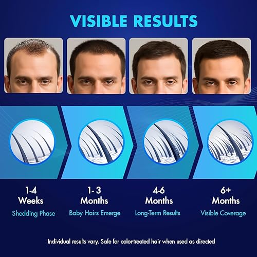 Miniatura 6 de Suero para el crecimiento del cabello de minoxidil al 5% para hombres y mujeres, paquete de 2 (2 × 1.0 fl oz)