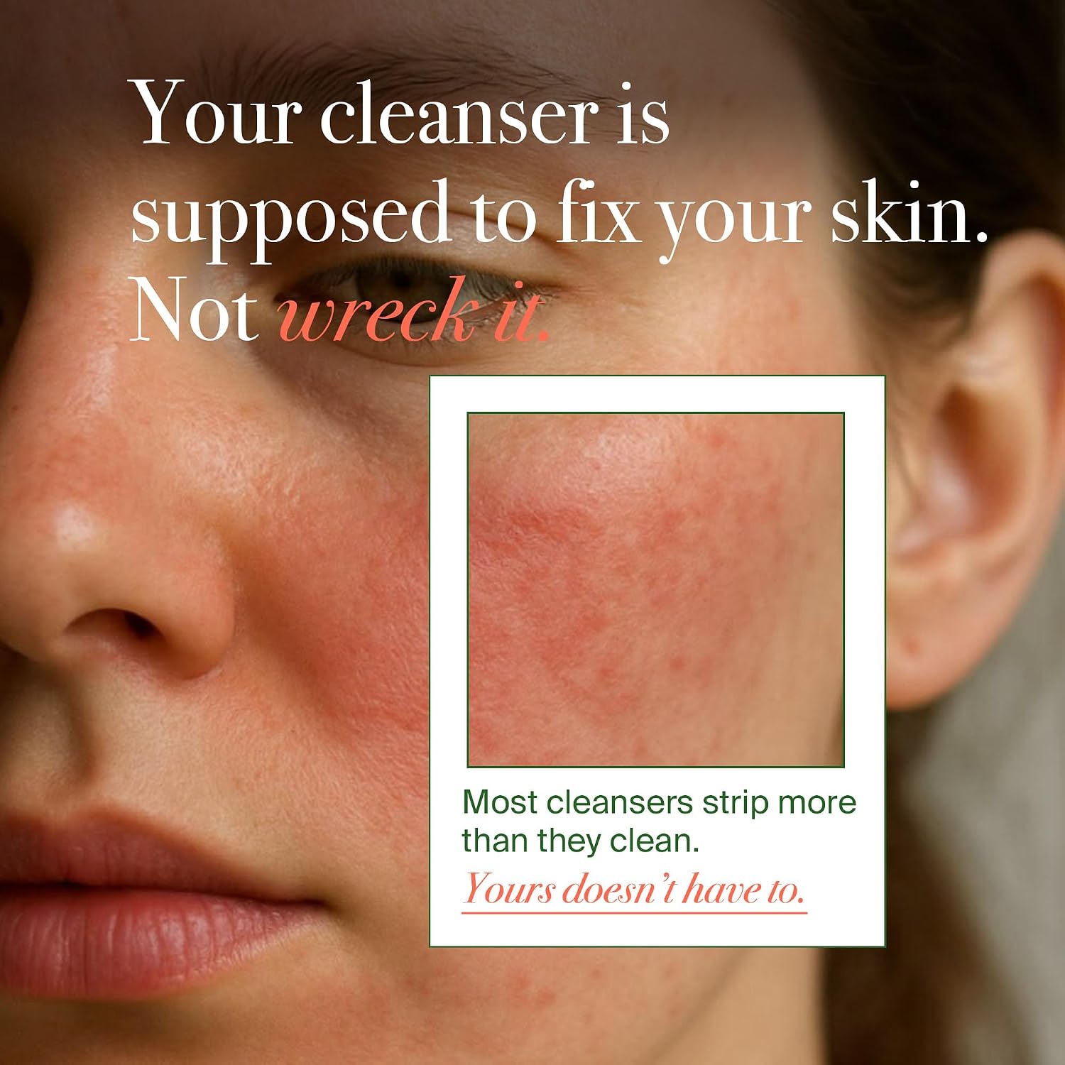 Matcha Rose PDRN Korean Face Wash, Low-pH Hydrating Calming Deep Pore Cleanser, Daily Gentle Facial Wash for Skin Texture, Blackhead & Pore Care, Korean Skincare, 5.07 fl.oz.