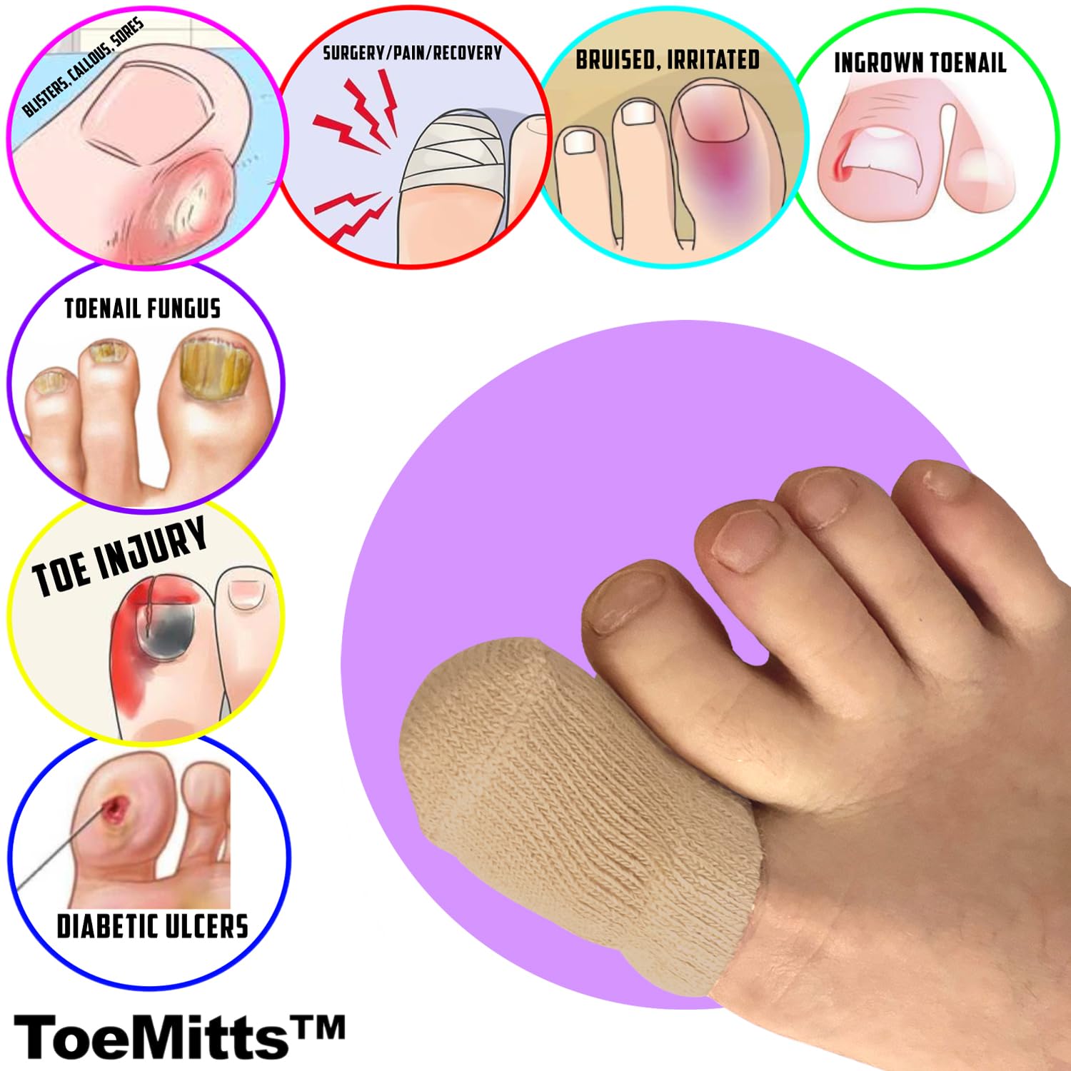 BOUNCEBACK Calcetines de punta grande para niños y adultos, calcetines de algodón con agarre de silicona antideslizante en el borde del puño interior, uñas de los pies, Desnudo/, Large/X-Large