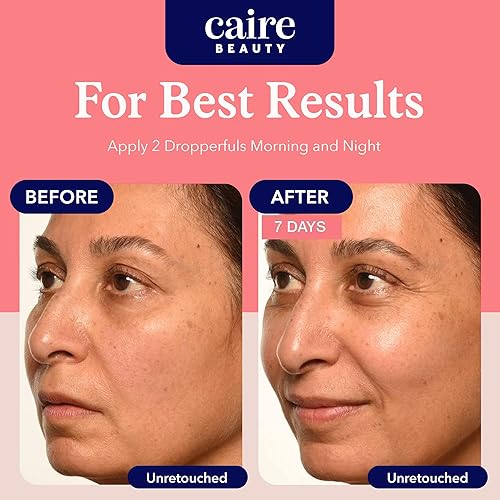 Miniatura 6 de Caire Suero de péptido de colágeno de ácido hialurónico biodisponible 'Own Your Age' para cara, ojos + cuello  0.5 fl oz