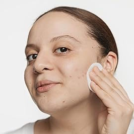 Clinique Acne Solutions Clarifying Lotion Exfoliating Facial Toner With Salicylic Acid | Reduces Oil + Unclogs Pores, 6.7 Fl Oz