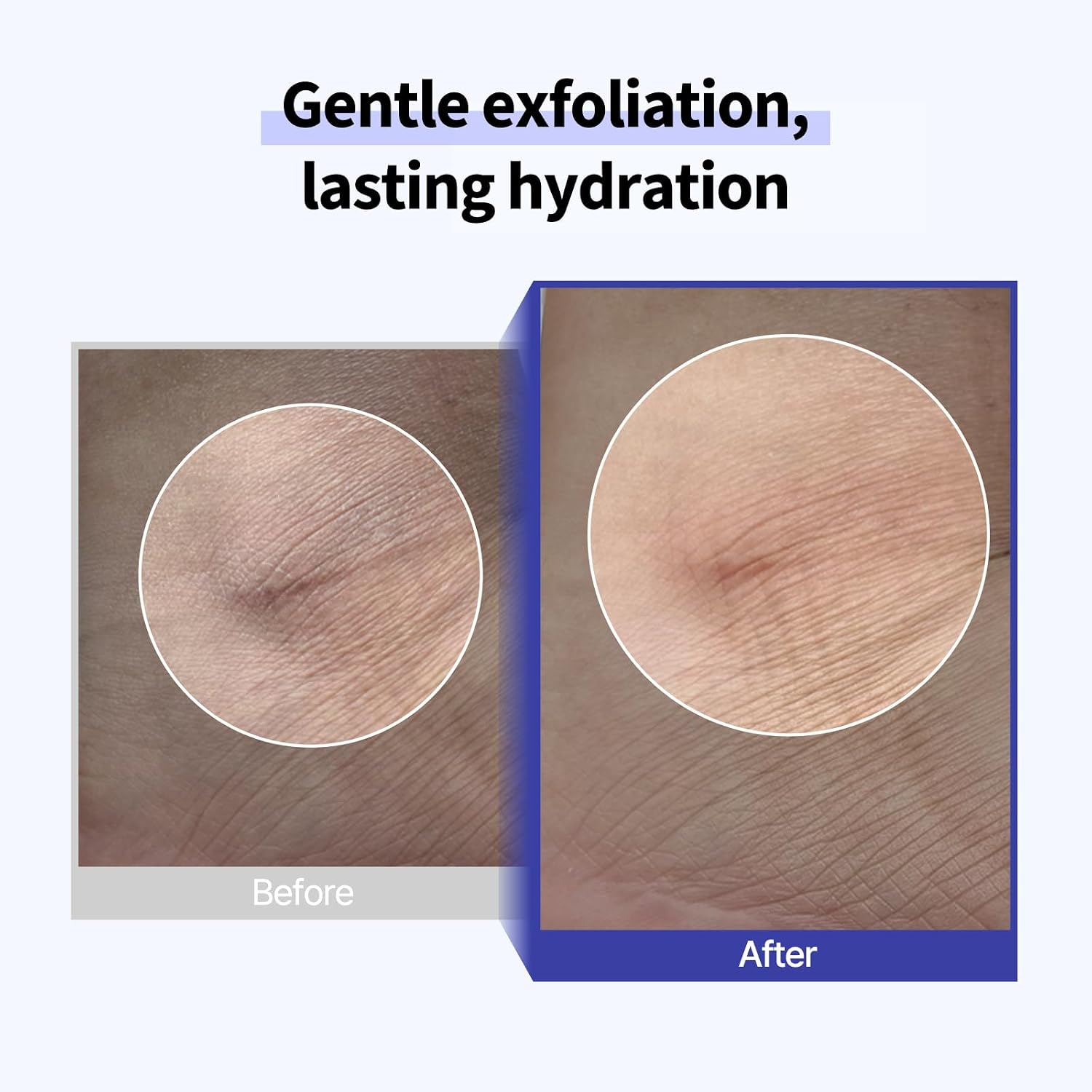 PONGDANG Deep Clean Soft Peeling Gel (4.23oz) | Gentel Exfolliation, Dead Skin Cells Remover for Face and Body Scrub | Pore Care, Clear Blackhead, Hydrating Facial Peel | Korean Skin Care