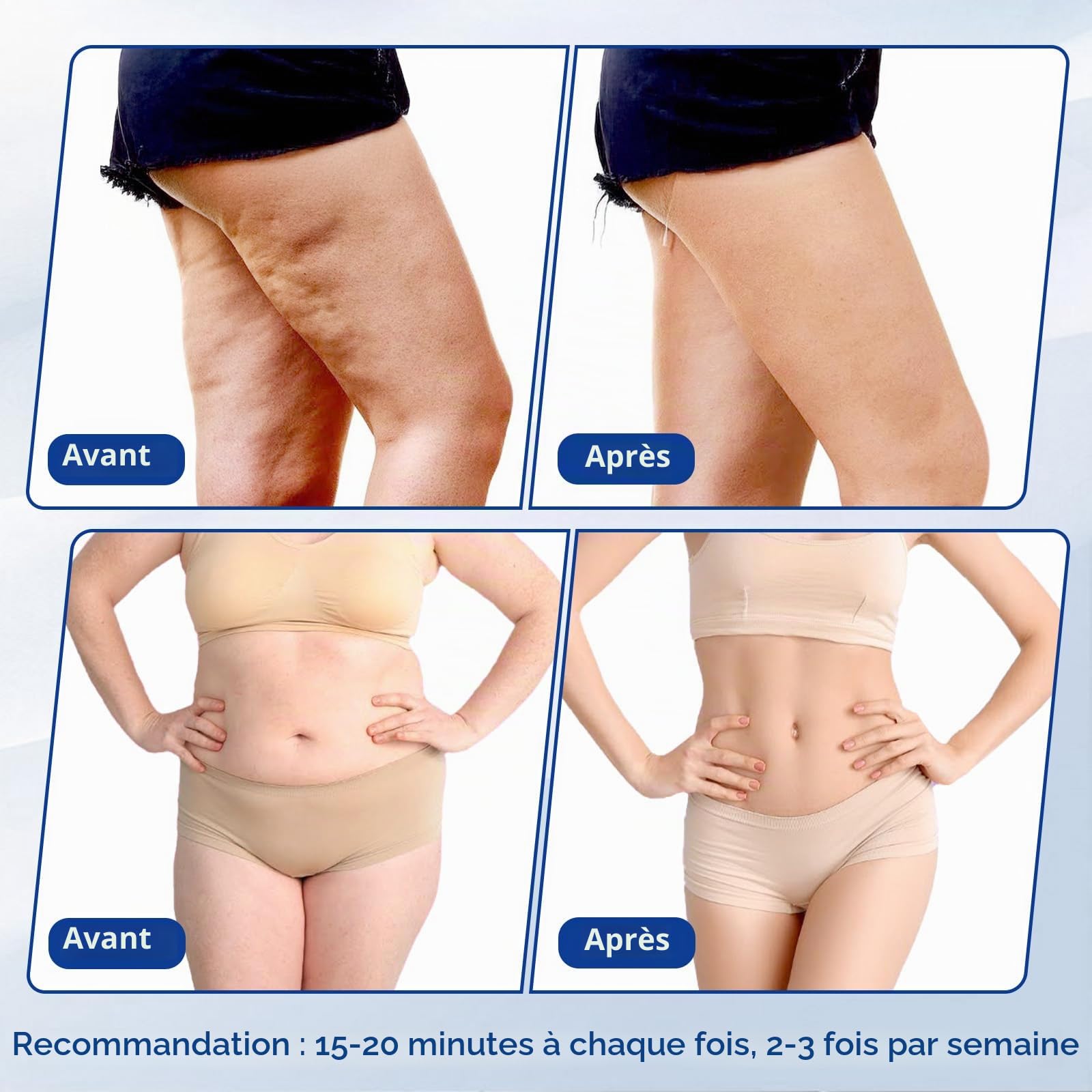 Cellulite 3-en-1 40K Cavitation et radiofréquence | RF 9 niveaux, ventouses visage et corps, facile et confortable à la maison