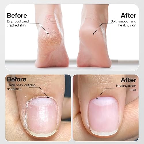 Miniatura 8 de Taladro de uñas inalámbrico, lima de uñas eléctrica, lima de uñas profesional para manicura y pedicura, kit de máquina de taladro de uñas recargable