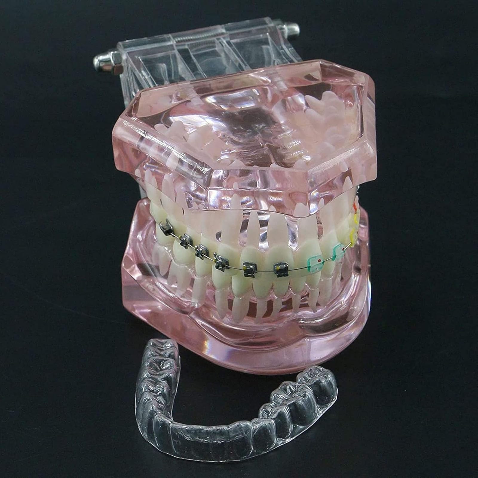 Zahnärztliches kieferorthopädisches Demonstrationsmodell,kieferorthopädisches Retainer-Behandlungsmodell für Zahnzähne mit selbstligierenden Metallklammern,die das Modell erklären