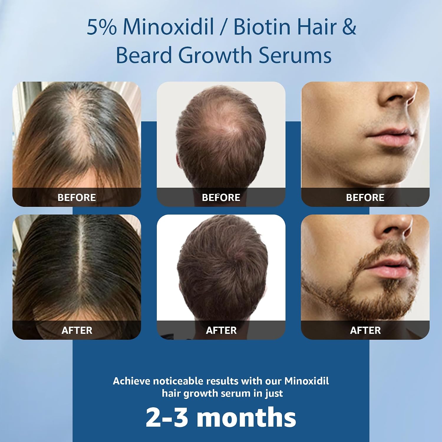 5% Minoxidil with Biotin for Men & Women, Extra Strength Hair & Beard Growth Liquid, Unscented Topical Solution for Thinning Hair Loss, 2 Pack