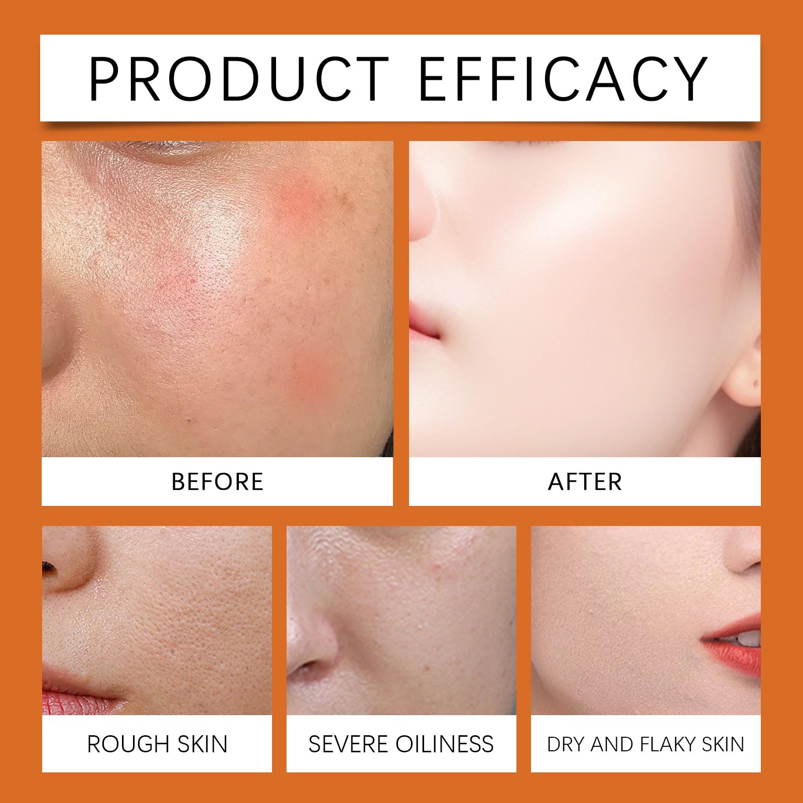 Bee Venom Firming Serum Stick, Flysmus Firming Serum Stick, Skin Tightening Cream For Face - Image 2
