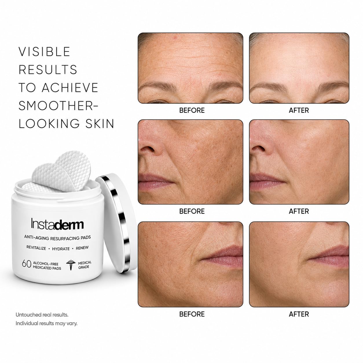 Instaderm Anti-Aging AHA + BHA Resurfacing Pads