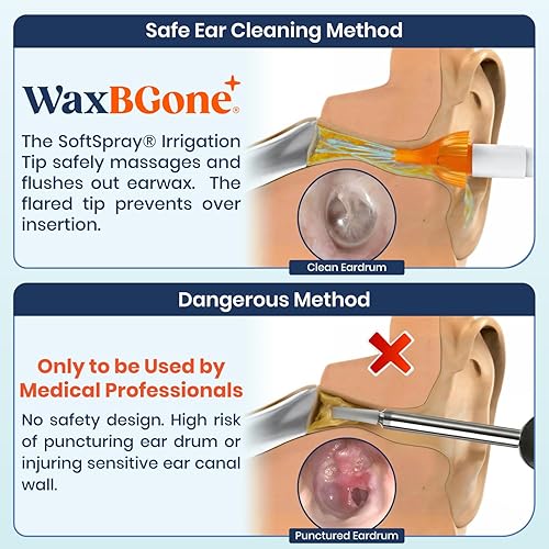 Vista 9 de Kit de eliminación de cera de oído WaxBGone® con otoscopio, gotas para la cera de oído, puntas de irrigación SoftSpray®, botella de spray de alta