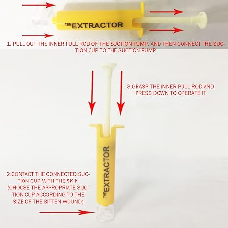 Bug Bite Suction Tool Poison Remover Bite Extractor Tool for Camping and Hiking