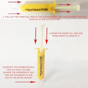 Bug Bite Suction Tool Poison Remover Bite Extractor Tool for Camping and Hiking