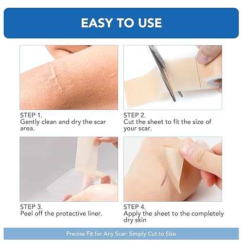 Miniatura 4 de Hojas de silicona para cicatrices, cinta adhesiva de silicona (rollo de 1.6 x 60 pulgadas - 4.9 ft), cinta adhesiva reutilizable, suave y de grado