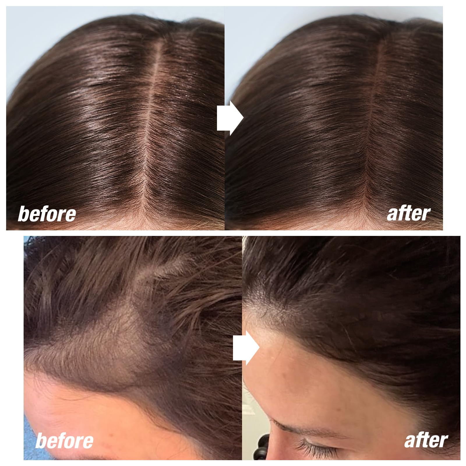 Boobeen Hairline Shadow Stick, Hair Root Concealer & Touch Up Powder With Sponge, Instant Cover Up For Thinning Grey Hair - Image 2