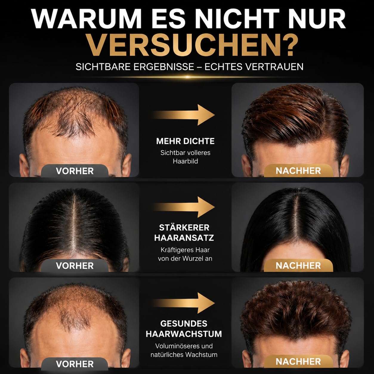 Rotlicht Haarwachstumskappe, 660nm+450nm+850nm Rotlicht Haare, Rotlichtlampe Haare Anti-Haarausfall, 4 Modi, Abnehmbarem Rotlicht Panel, Hair Growth Cap für Männer/Frauen