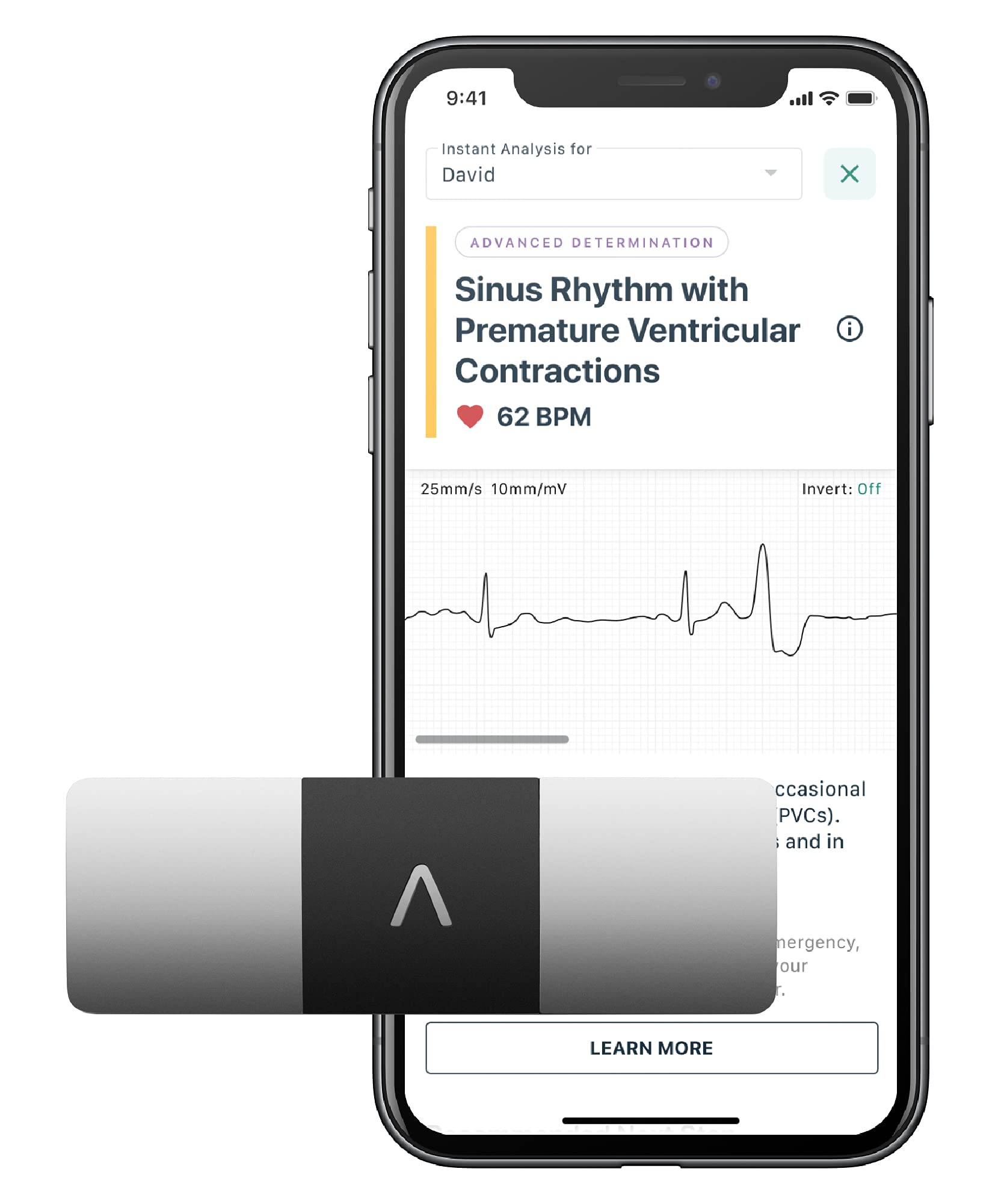 Buy AliveCor KardiaMobile 6L Personal EKG Device and Heart Monitor