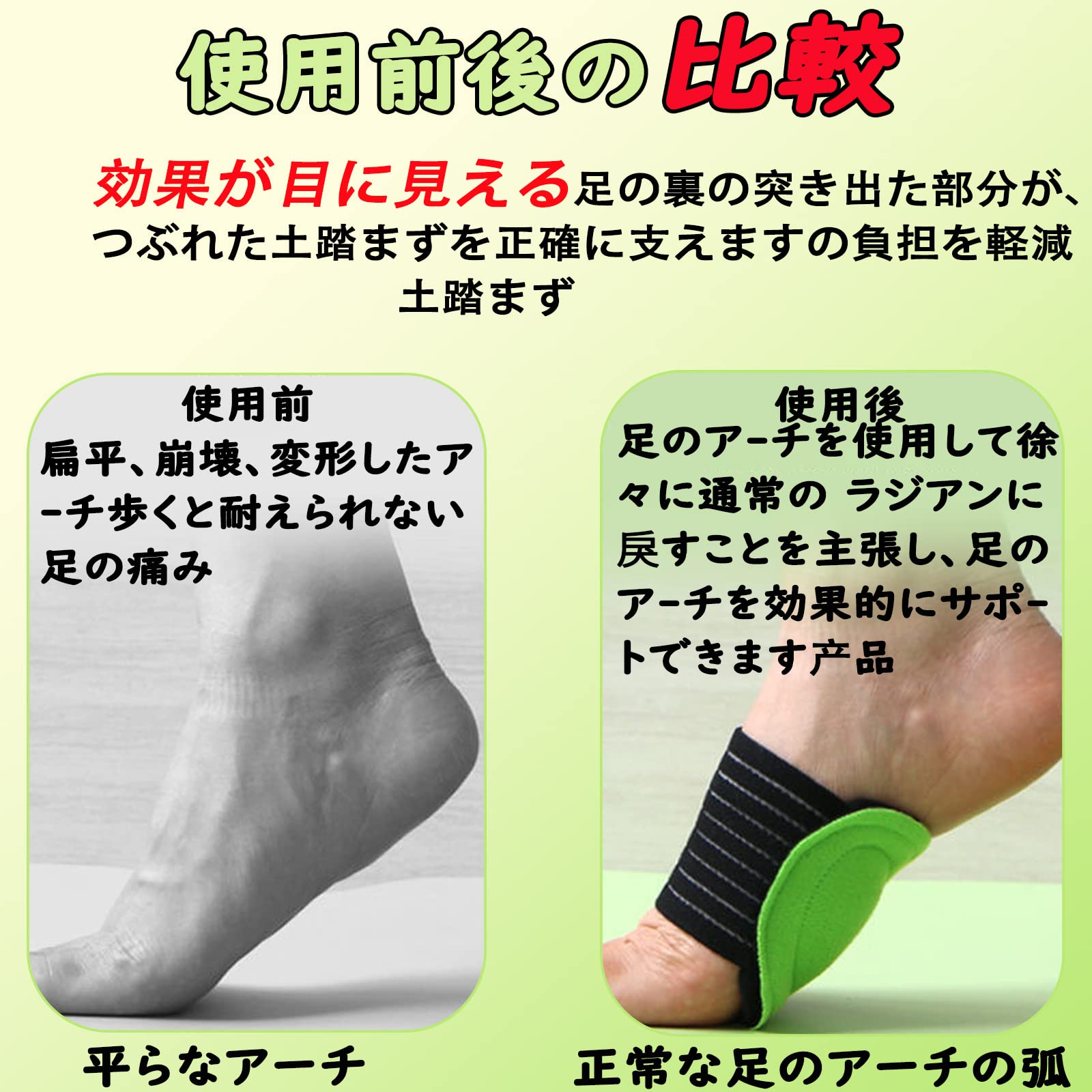 Amazon | 扁平足 サポーター 土踏まず 足用アーチサポーター 足