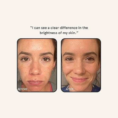 Miniatura 8 de Barefaced Liquid Gold - Suero de 15% vitamina C con ácido hialurónico y vitamina E para antienvejecimiento e hidratación, fórmula antioxidante,