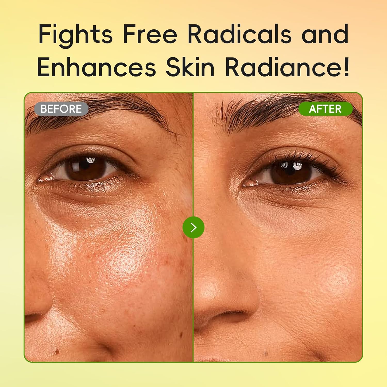 Skin Care Set for Oily/Combination Ance Skin, 5PCS Natural Fruit Skincare Kit with Salicylic Acid, Vit-C & Peptide, Birthday Gifts for Women | Oil Control | Brightening | Anti-Acne | Gift Sets - Image 6