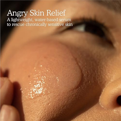 Miniatura 4 de Tower 28 SOS - Suero de rescate intensivo para pieles sensibles, cuidado de la piel con ácido hipocloroso, ayuda a reducir el enrojecimiento facial,