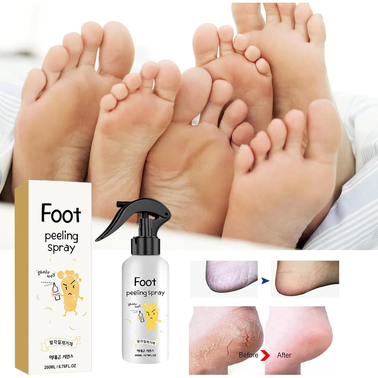 Foot Peeling Spray for Dry Cracked Feet, Exfoliating Foot Peel Mask Spray with Natural Plant Extracts, Fast-Acting Foot Care Callus Remover to Remove Dead Skin Soften Rough Heels - 200ml/6.76fl.oz (2)