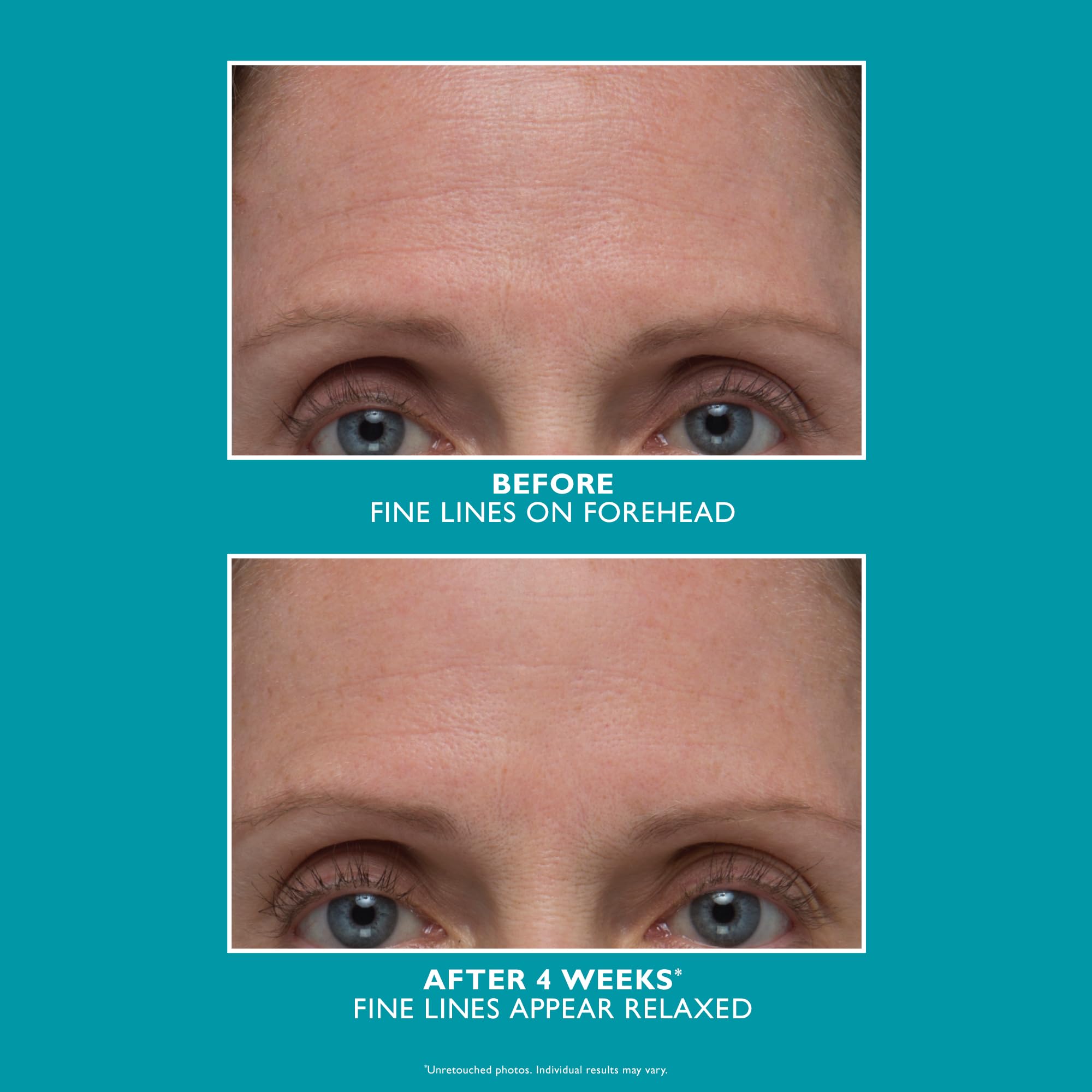 Peter Thomas Roth - Peptide Skinjection™ Faltenreduzierendes Serum Nachfüllbar – Anti-Aging Serum mit Peptiden, Glättende Pflege & Intensiver Feuchtigkeit