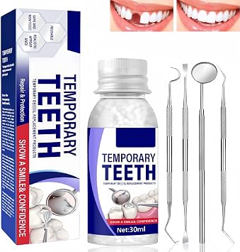 Temporary Tooth Repair Kits, Den/tal Repair Kit, Tooth Filling Kit, Den/tal Filling Kit for Restoring Missing Teeth, Moldable False Teeth Beads for Temporary Fixing & Filling Missing or Broken Teeth