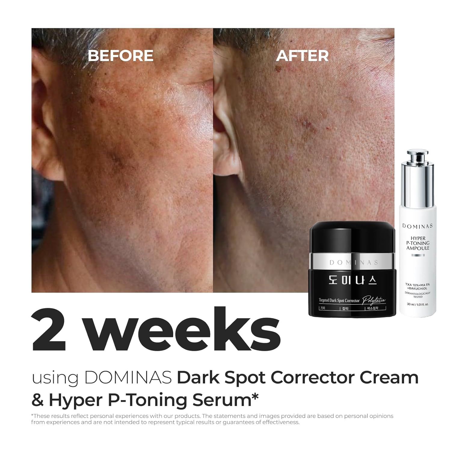 DOMINAS Dark Spot Corrector Cream - Visibly Reduce Age Spots, Sun Spots with TXA, Niacinamide and Bakuchiol, Brightening Daily Moisturizer for Uneven Tone and After Spot Care, Korean Skincare, 1.76 oz - Image 4